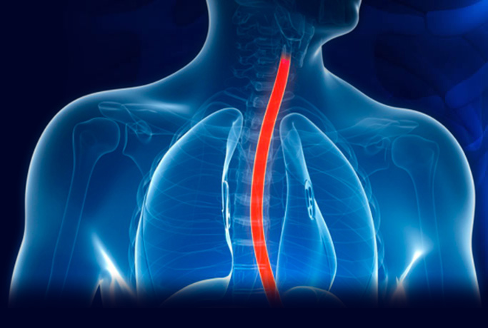 A reflux tünetei és a reflux okai testi és lelki vonatkozásban – reflux-kezeles.wallingerzita.hu