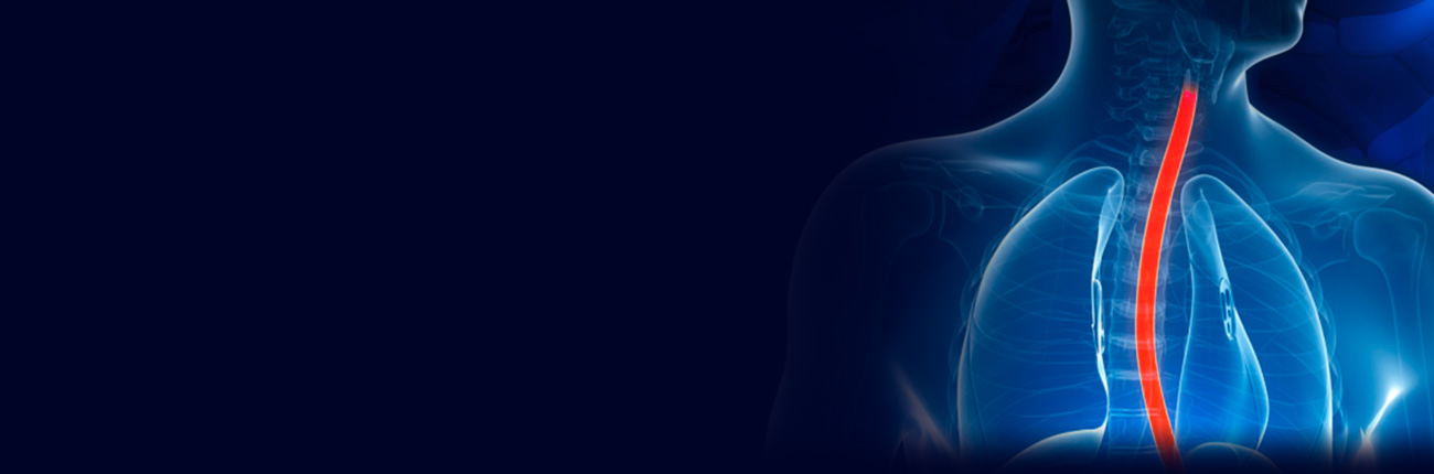 Mi a reflux? Hogyan teszi pokollá az életed a gyomorégés? – reflux-kezeles.wallingerzita.hu